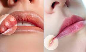 tingling lips may signify a stroke is