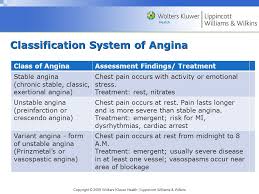 Unstable angina *part 5* (s/s, pharmacology, nursing consi. Chapter 21 Acute Myocardial Infarction Ppt Video Online Download