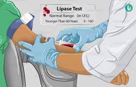 lipase test procedure purpose