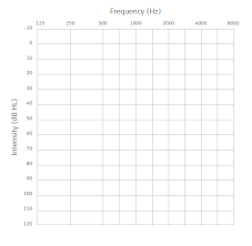 What Is An Audiogram The Med El Blog