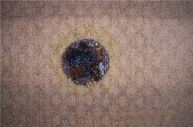 You will need to cut out the new patch of carpet using extra carpet or cut out a square in the closet. How To Fix Hookah Burned Carpet Azara Hookah