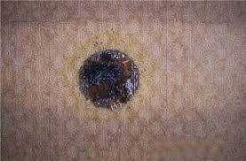 how to fix hookah burned carpet azara