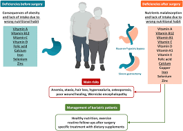 obesity and after bariatric surgery