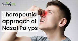 nasal polyps causes symptoms