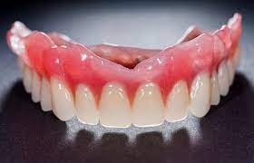 what is denture adhesive and do i need