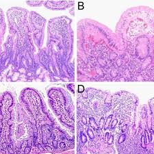 The small intestine is an organ located in the gastrointestinal tract, between the stomach and the large intestine. Histopathology Of The Small Intestine H E Stained Tissue Sections Of Download Scientific Diagram