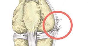 al knee pain inside symptoms
