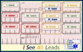 I See All Leads Ekg Cardiac Nursing Critical Care
