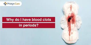 why do i have blood clots in periods