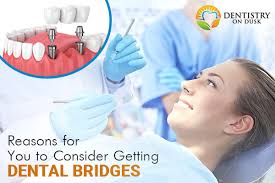 dental bridges