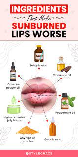 7 natural treatments for sunburned lips