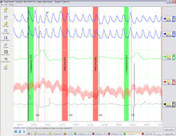 Questions For Polygraph Examiners On Countermeasures