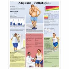 Adipositas (fettleibigkeit) beschreibt eine erkrankung, die mit starkem übergewicht einhergeht. Adipositas Fettleibigkeit 1001396 Vr0460l Sucht 3b Scientific