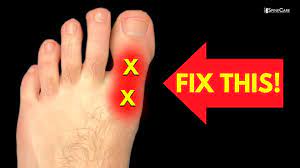 how to fix big toe pain for good you