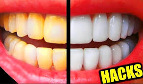 Doctors explain how to tell if you have a head cold or something more serious that requires medical attention, such as the flu, strep throat, meningitis, or mono. 20 Ways To Whiten Your Teeth Naturally At Home Life Hack Solution