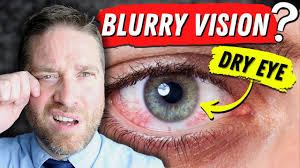 why dry eyes cause blurry vision 3