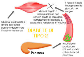 Risultati immagini per diabete mellito tipo 2