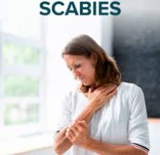 scabies symptoms causes treatments
