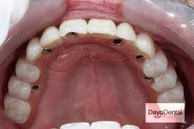 Dayo Dental gambar png