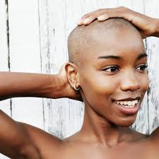 It may be caused by your immune. 5 Things I Learned About Alopecia On My Hair Growth Journey Essence