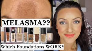melasma which foundations cover it