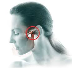 temporomandibular joint pain