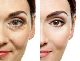 get rid of wrinkles under your eyes