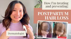 dermatologist tips for postpartum hair