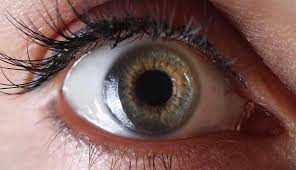 retinal detachment 3 most common