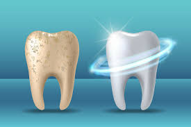 dental benefits of nano hydroxyapae