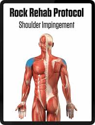 shoulder impingement climbing rehab