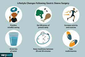 gastric sleeve surgery long term care