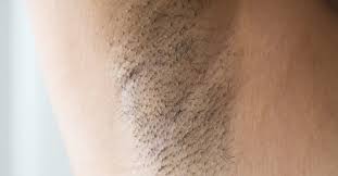 Infected hair follicles medically referred to simply as folliculitis results from the bacterial infection of the hair follicles. Armpit Pain Common Causes And Treatments
