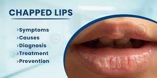 chapped lips symptoms causes