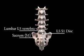 l5 s1 disc pain treatment options