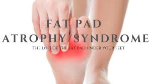 Fat Pads Atrophy Syndrome Well Heeled