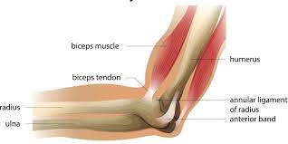 bicep tendonitis elbow a common injury