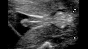Physiotherapist David Fraser Case study Ultrasound Imaging    