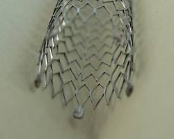 صورة Baremetal stent