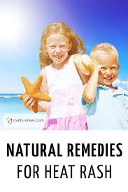 natural remes for heat rash in children