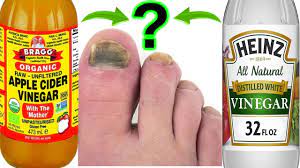 what is better for toenail fungus