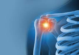 shoulder surgery recovery what to know