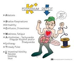 symptoms of low potium hypokalemia