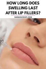 swelling last after lip fillers