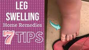 7 tips for leg swelling treatment at