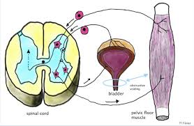 intersial cysis bladder pain