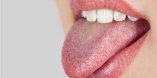 type 2 diabetes dry mouth 5 easy tips