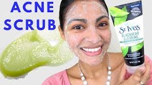 acne treatment st ives green tea scrub