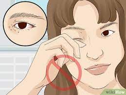 4 ways to improve under eye skin wikihow