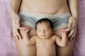 c section recovery the dangers of